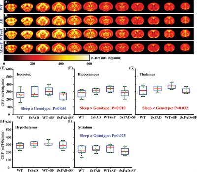 Metabolic and vascular imaging markers for investigating Alzheimer’s disease complicated by sleep fragmentation in mice